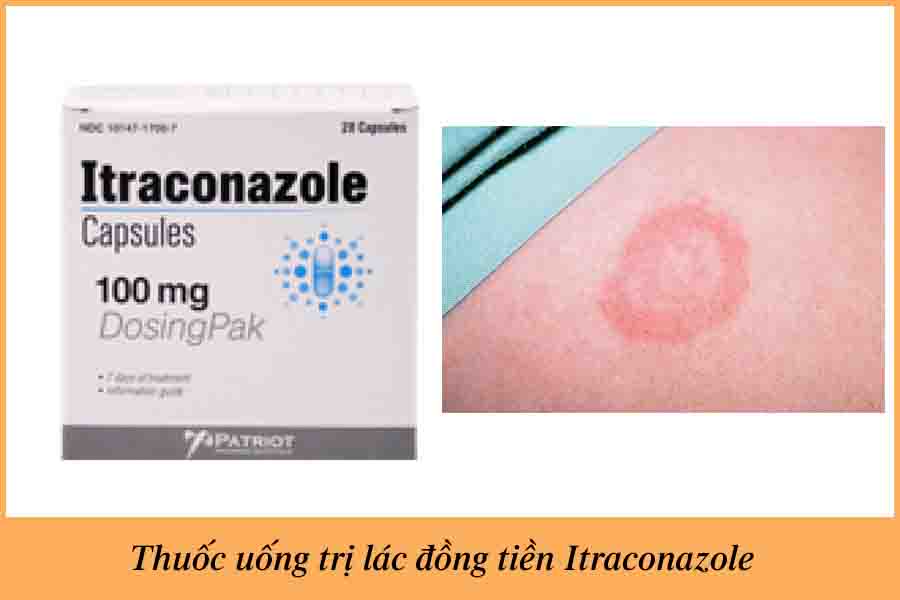 thuoc uong lac dong tien Itraconazole