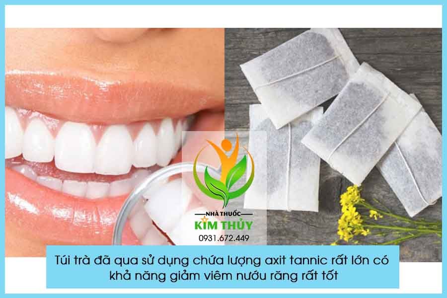 Cách chữa bệnh viêm nướu răng với túi trà